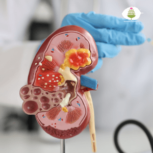 Kidney Diseases - Shree Vishwa Anand